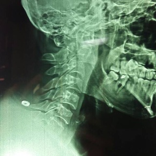 Логотип канала neurosurgerynotes