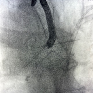 Логотип канала pilylkin_pulmonology