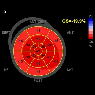 Логотип канала simple_echocardiography