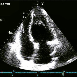 Логотип канала echocardiographist