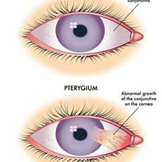 Логотип канала opthalmology9600